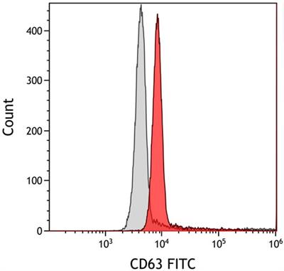 Tumor-Derived Exosomal RNA From Fine-Needle Aspiration Supernatant as a Novel Liquid Biopsy for Molecular Diagnosis of Cancer